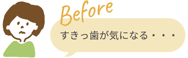 Before すきっ歯が気になる・・・